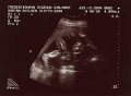 Baby001